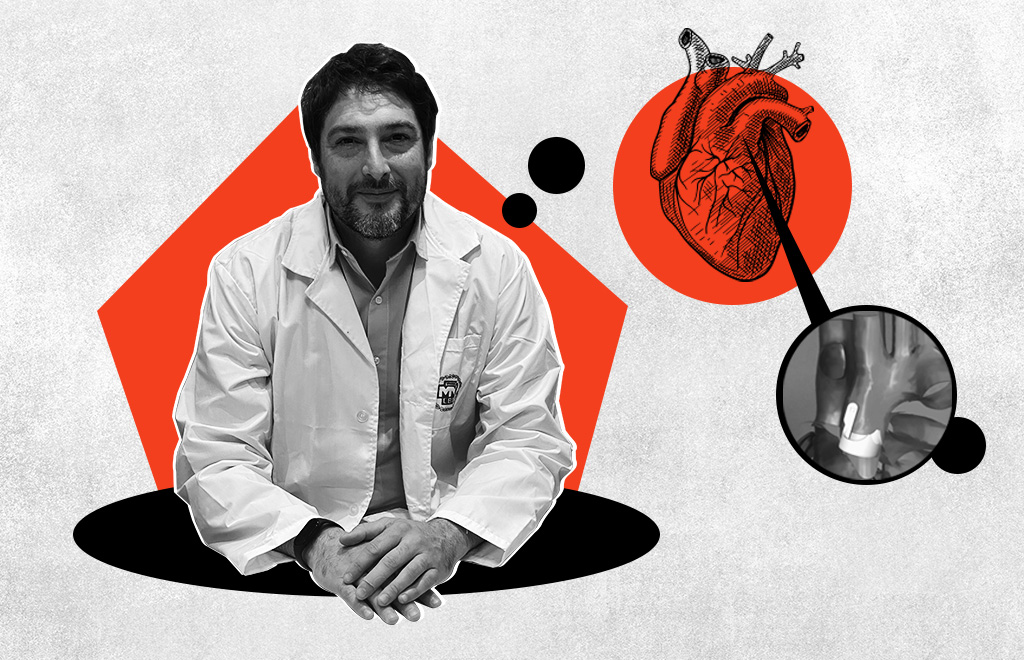 Un cirujano cardiovascular argentino desarrolló con la ayuda de tecnología 3D un modelo que puede salvar la vida de muchos niños