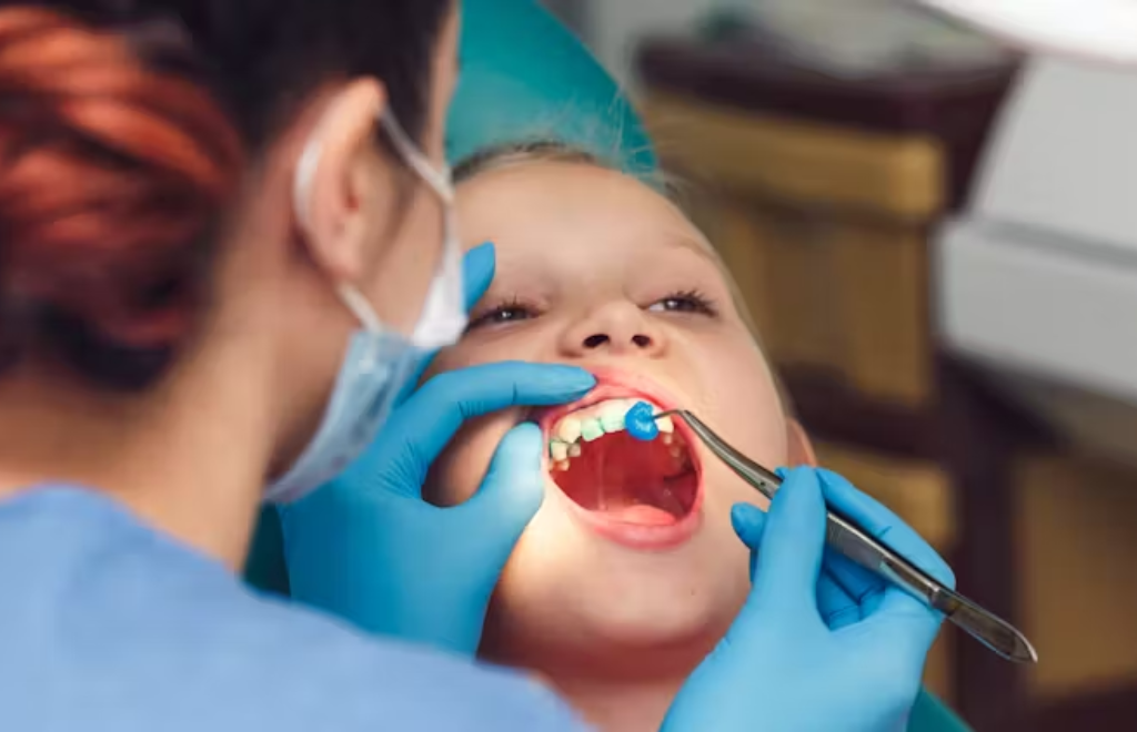 Las manchas en los dientes de los niños pueden revelar futuras caries y fracturas